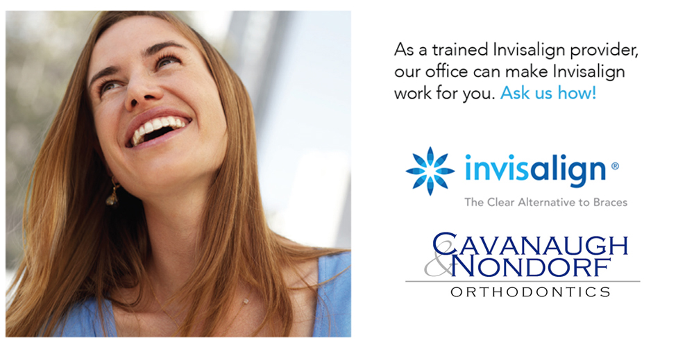 10 Things Parents Need to Know About Invisalign Teen